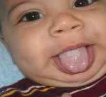 Bílý povlak jazyka u dětí - příčiny, příznaky, léčba