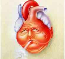 Chronické srdeční selhání