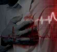 Ischemická choroba srdeční a stentu cév srdce