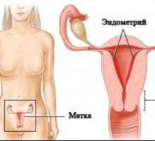 Děloha Endometrióza: Příznaky