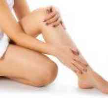 Příčiny nohy edém u žen