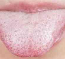 Příčiny sucha v ústech a povlak jazyka