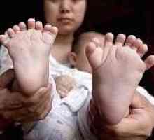 V Číně se narodilo dítě s 31 prsty