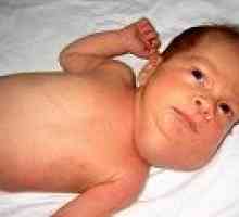 Vrozená lymfangiom dítěte: příznaky a léčba