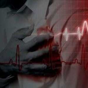 Ischemická choroba srdeční a stentu cév srdce