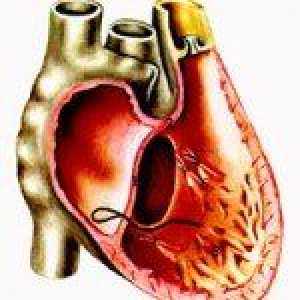 Srdeční astma