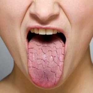 Sucho v ústech - způsobuje nemoc
