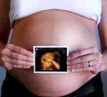 3D ultrazvuk v těhotenství