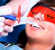 Čištění zubů ultrazvukem: hodnocení před a po