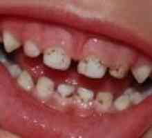 Co dělat, když vaše dítě plak na zubech?
