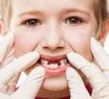 Zánět dásní je dítě: příčiny, příznaky, léčba