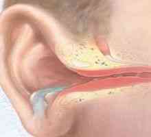 Hnisavý zánět středního ucha - střední, akutní, chronické, hnisavý zánět středního ucha u dětí,…
