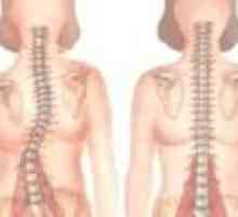 Kýly spinální SHmorlja: příznaky, léčba