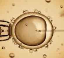 In vitro fertilizace (IVF) - jak se připravit?