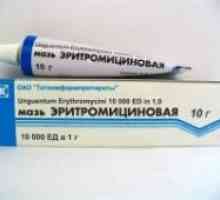 Erythromycin mast na akné: účinné látky, využití, kontraindikace