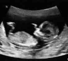 Jak dešifrovat ultrazvuku v průběhu těhotenství?