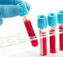 Jaký je podíl hemoglobinu v krvi žen?