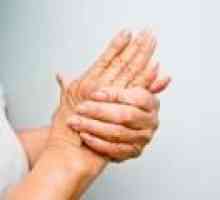 Bolavé klouby na rukou a nohou: příčiny, léčba