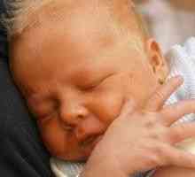 Norma bilirubin u novorozenců