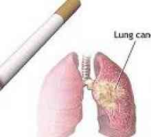 Příčiny rakoviny plic u kuřáků