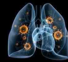 Virové pneumonie - příčiny, příznaky, diagnostika a léčba