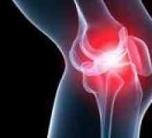 Zánět kolenního kloubu, příčiny, příznaky a léčba