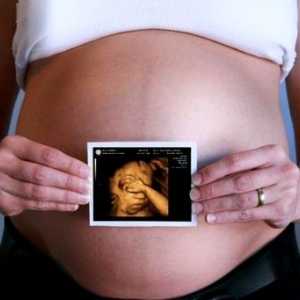 3D ultrazvuk v těhotenství