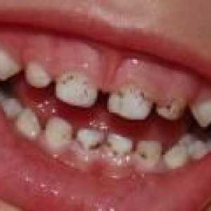 Co dělat, když vaše dítě plak na zubech?
