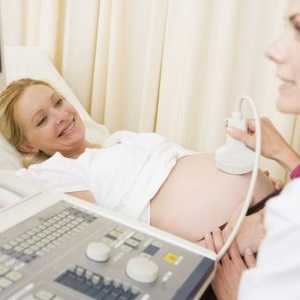 Doppler ultrazvuk v těhotenství - co to je?