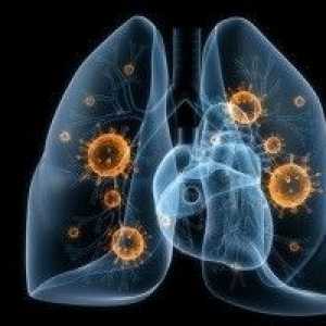 Virové pneumonie - příčiny, příznaky, diagnostika a léčba