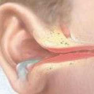 Zánět středního ucha: příčiny, léčba